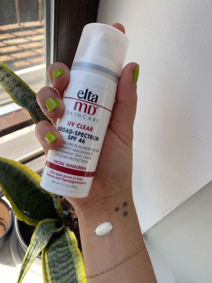 Chăm dùng mỹ phẩm chứa Niacinamide, làn da bạn chắc chắn trẻ ra ít nhất 5 tuổi - Ảnh 1. Chăm dùng mỹ phẩm chứa Niacinamide, làn da bạn chắc chắn trẻ ra ít nhất 5 tuổi - Ảnh 1.