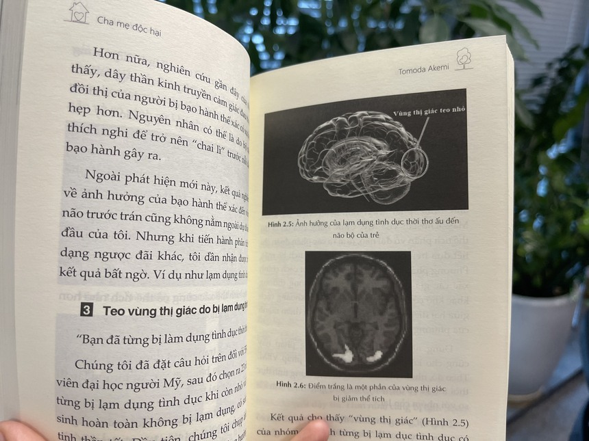 "Cha mẹ độc hại", cuốn sách có thể khiến nhiều phụ huynh thức tỉnh, nhận ra đâu là lối đi đúng trên hành trình nuôi dạy con - Ảnh 3.