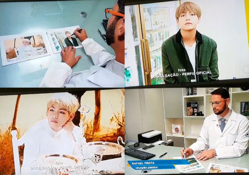 Bác sĩ thẩm mỹ nổi tiếng Nhật Bản: V BTS có khuôn mặt lý tưởng mà cánh mày râu ao ước  - Ảnh 4.