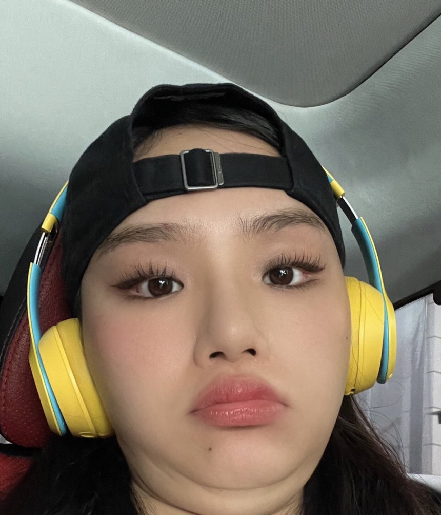 Sao Việt 3/10: Lê Dương Bảo Lâm rơi răng, Sam bị nghi có bầu - Ảnh 5.