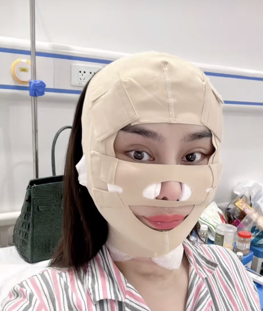 Lâm Khánh Chi kể tường tận quá trình căng da mặt, dân mạng nghe mà 'hết hồn' - Ảnh 5.