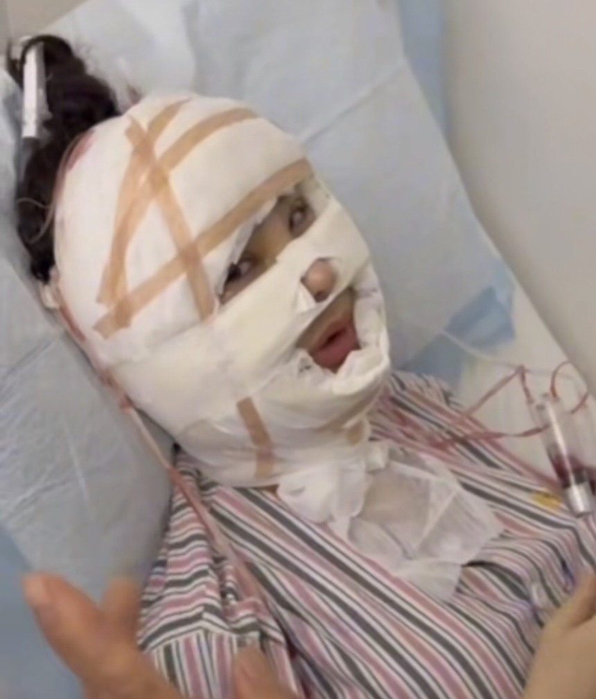 Lâm Khánh Chi kể tường tận quá trình căng da mặt, dân mạng nghe mà 'hết hồn' - Ảnh 3.