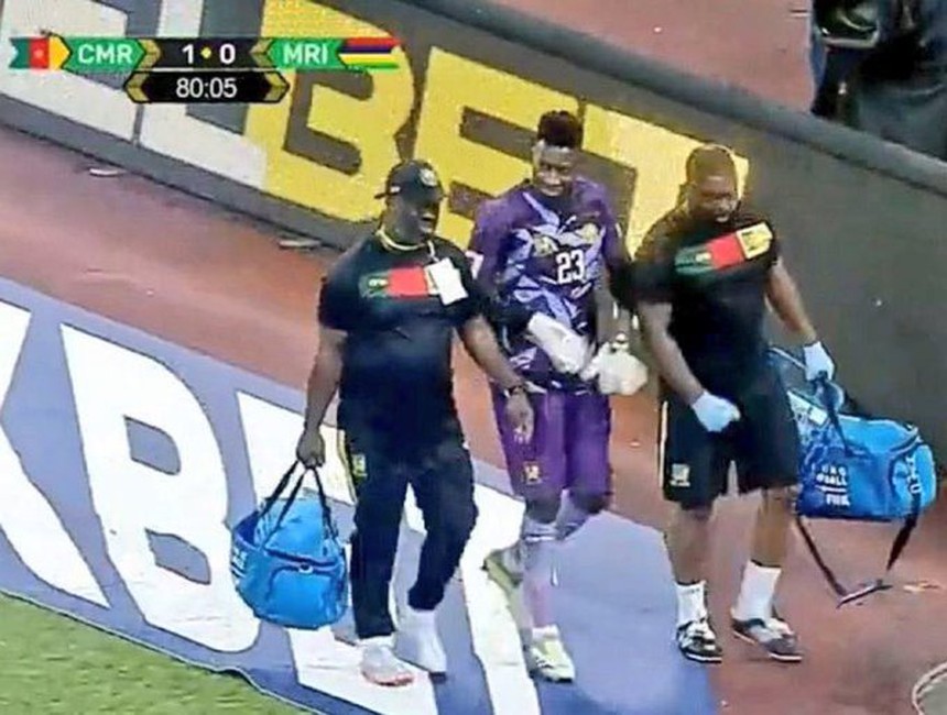 Hai ngôi sao MU chấn thương cùng 1 ngày, HLV Ten Hag càng thêm đau đầu - Ảnh 3. Hai ngôi sao MU chấn thương cùng 1 ngày, HLV Ten Hag càng thêm đau đầu - Ảnh 3.