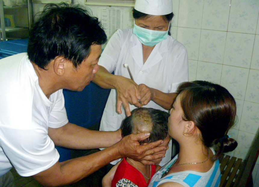 Hơn 1.000 người phải đến cơ sở y tế điều trị dự phòng bệnh dại - Ảnh 1.