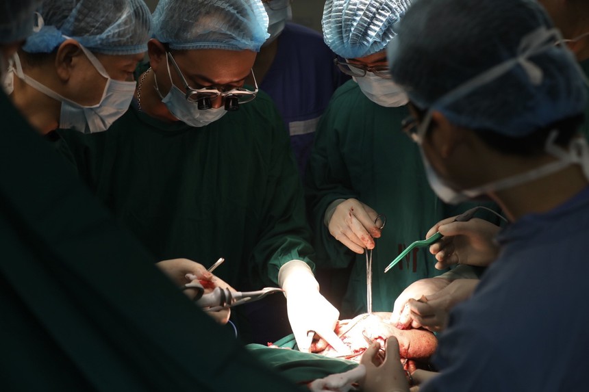 Cắt khối u gần 6,5 kg trong bụng cô gái 28 tuổi - Ảnh 1.