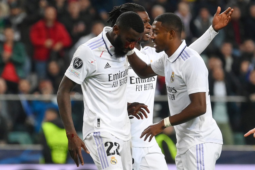 03h00 ngày 16/2, sân Bernabeu, Real Madrid - Elche: Đôi chân pha lê - Ảnh 1.