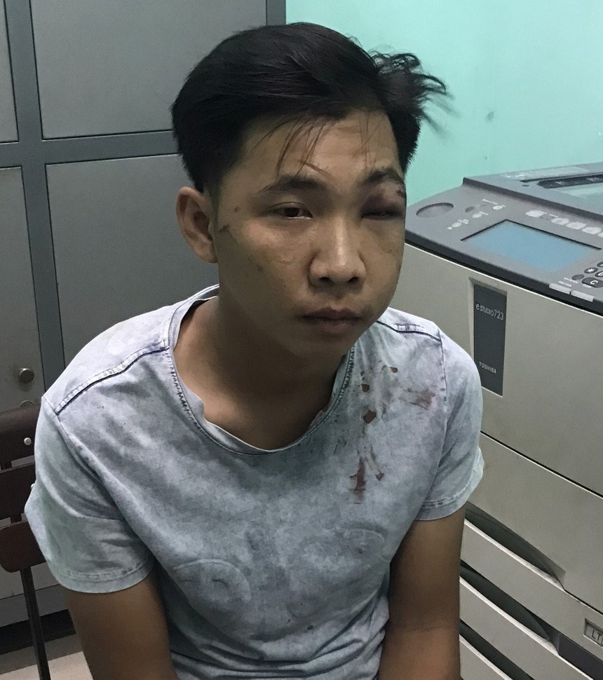 Bình Dương: Bắt giữ các đối tượng chém 2 người thương vong sau va chạm giao thông - Ảnh 1.