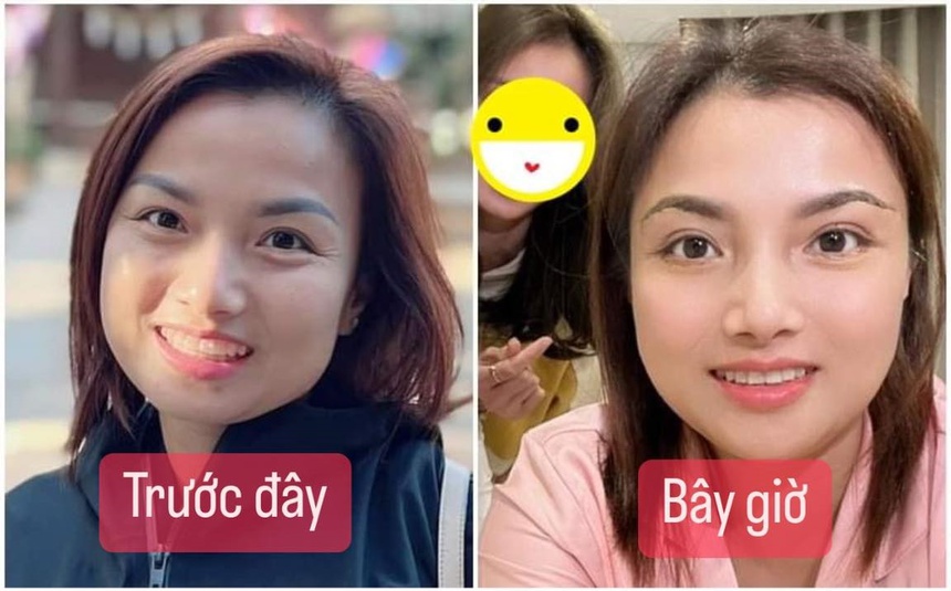 Cận cảnh nhan sắc Quỳnh Trần JP sau khi tiêm gọn hàm và nâng ngực, được dân mạng khen trẻ đẹp trông thấy - Ảnh 2.