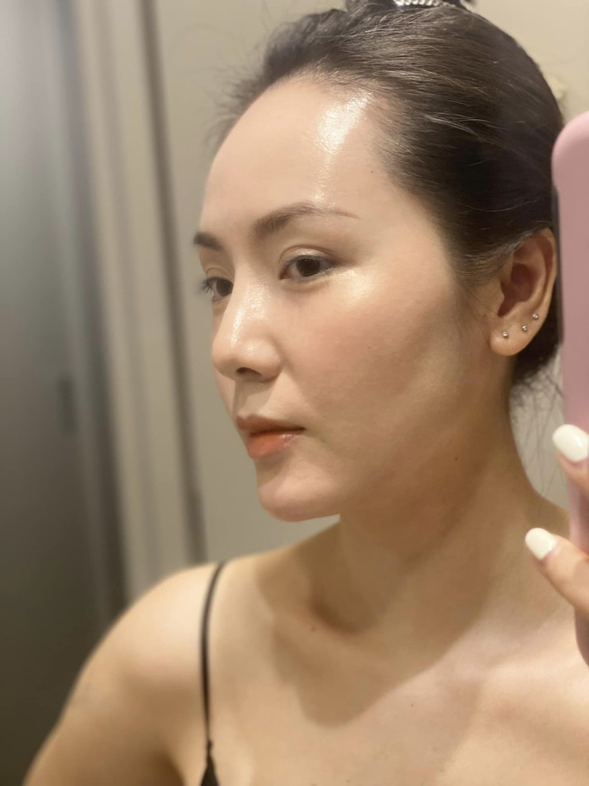 Phương Linh tiết lộ sự cố khiến mũi bị biến dạng - Ảnh 1.