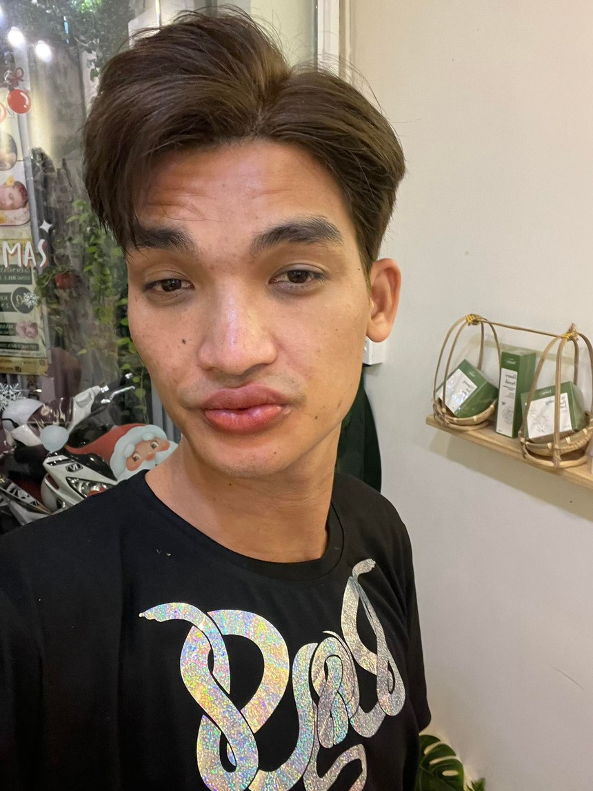 Mạc Văn Khoa bị sưng tấy môi vì làm đẹp để đóng phim, về nhà con gái không nhận ra - Ảnh 4. Mạc Văn Khoa bị sưng tấy môi vì làm đẹp để đóng phim, về nhà con gái không nhận ra - Ảnh 4.