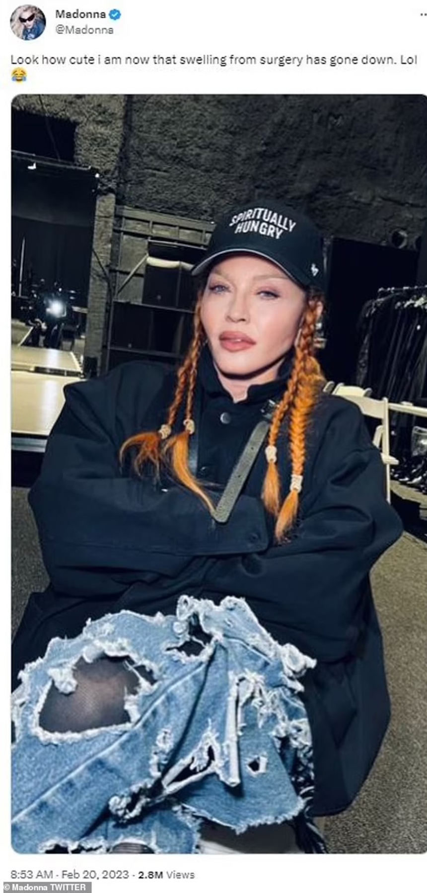 Madonna cuối cùng thừa nhận phẫu thuật thẩm mỹ sau lần xuất hiện không thể nhận ra tại lễ trao giải Grammy - Ảnh 1.