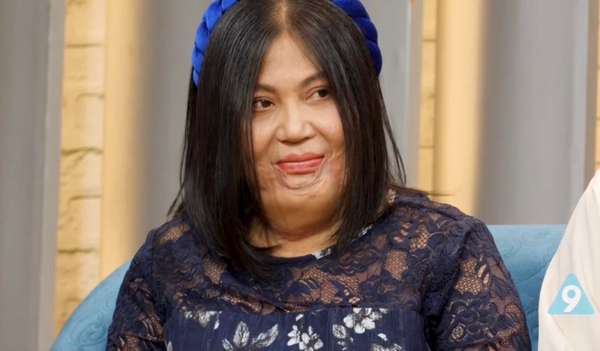 Mặt biến dạng sau một buổi tối, cô gái trẻ bị chồng sắp cưới quay lưng, chia tay ngay tại bệnh viện - Ảnh 2.