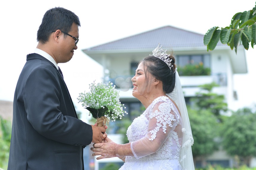 Mặt biến dạng sau một buổi tối, cô gái trẻ bị chồng sắp cưới quay lưng, chia tay ngay tại bệnh viện - Ảnh 3.