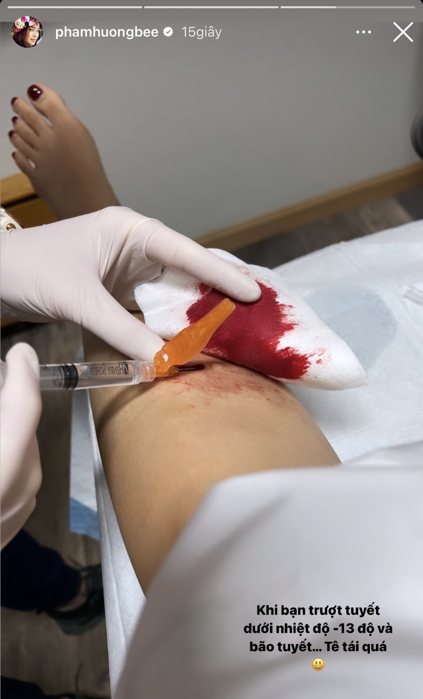 Bị thương ở chân khi đi trượt tuyết dưới thời tiết -13 độ C, Hoa hậu Phạm Hương phải tới bệnh viện gấp - Ảnh 1. Bị thương ở chân khi đi trượt tuyết dưới thời tiết -13 độ C, Hoa hậu Phạm Hương phải tới bệnh viện gấp - Ảnh 1.