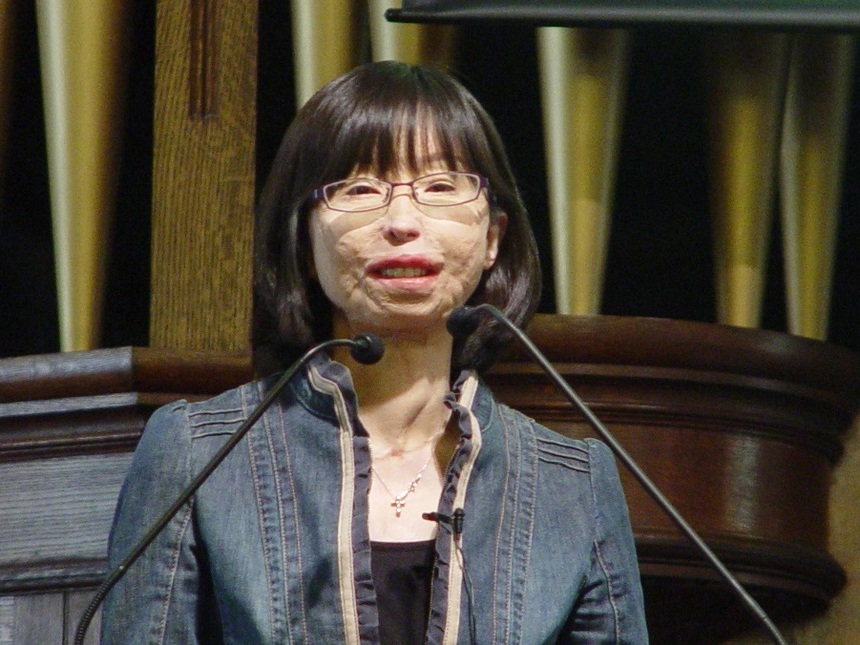 Từng bị tai nạn hủy hoại gương mặt, cuộc sống của nữ sinh trường đại học danh giá sau 23 năm khiến ai nấy quá ngưỡng mộ - Ảnh 3.