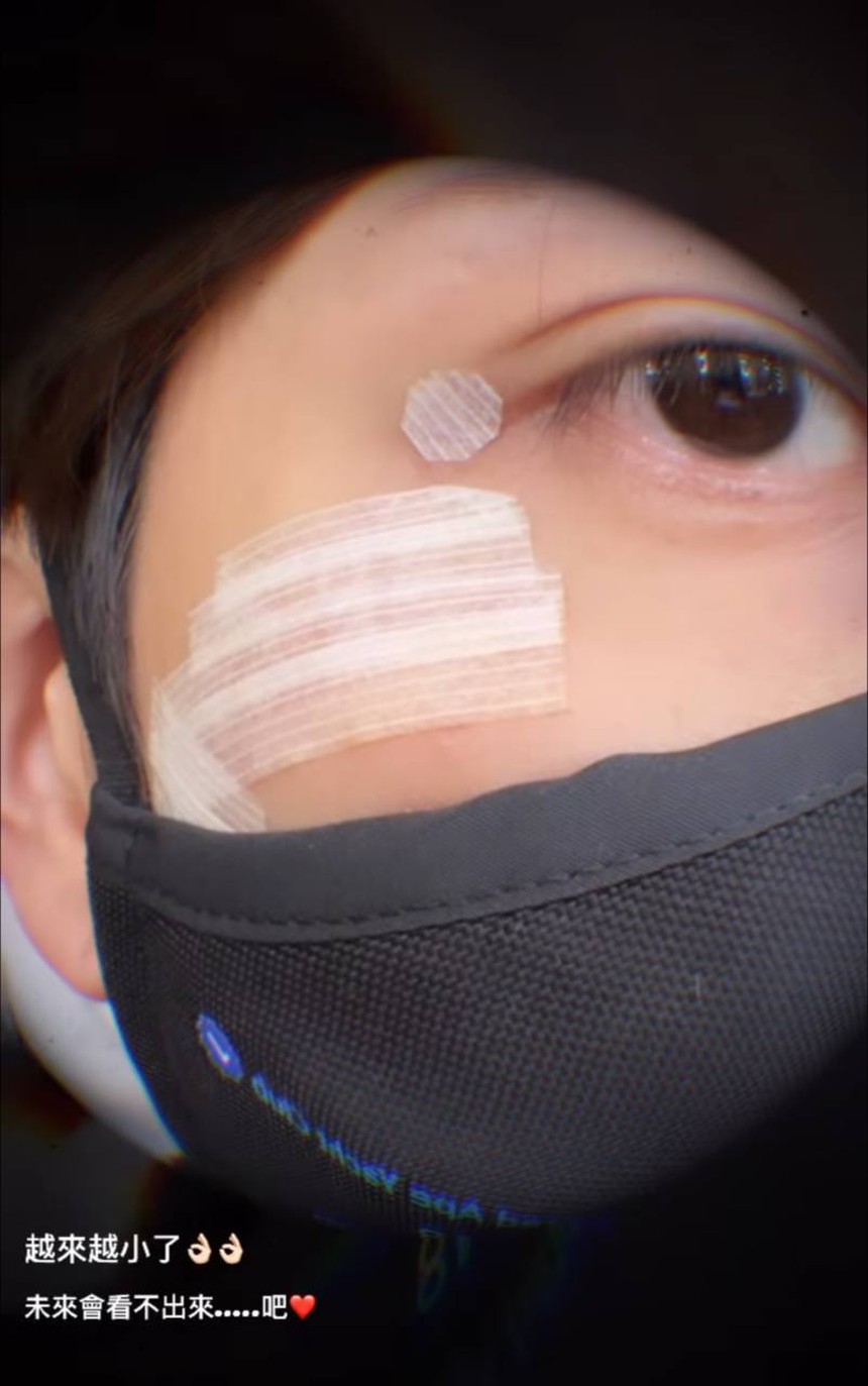 'Nam thần thanh xuân' Kha Chấn Đông chính thức lộ diện sau tai nạn nổ mặt, nhan sắc có còn như xưa? - Ảnh 9.