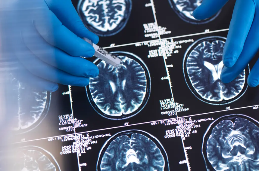 Thử tài "bắt mạch" của ChatGPT, bất ngờ khả năng chẩn đoán chính xác tới 80% căn bệnh đang ám muội hơn 50 triệu người trên toàn thế giới - Ảnh 2.