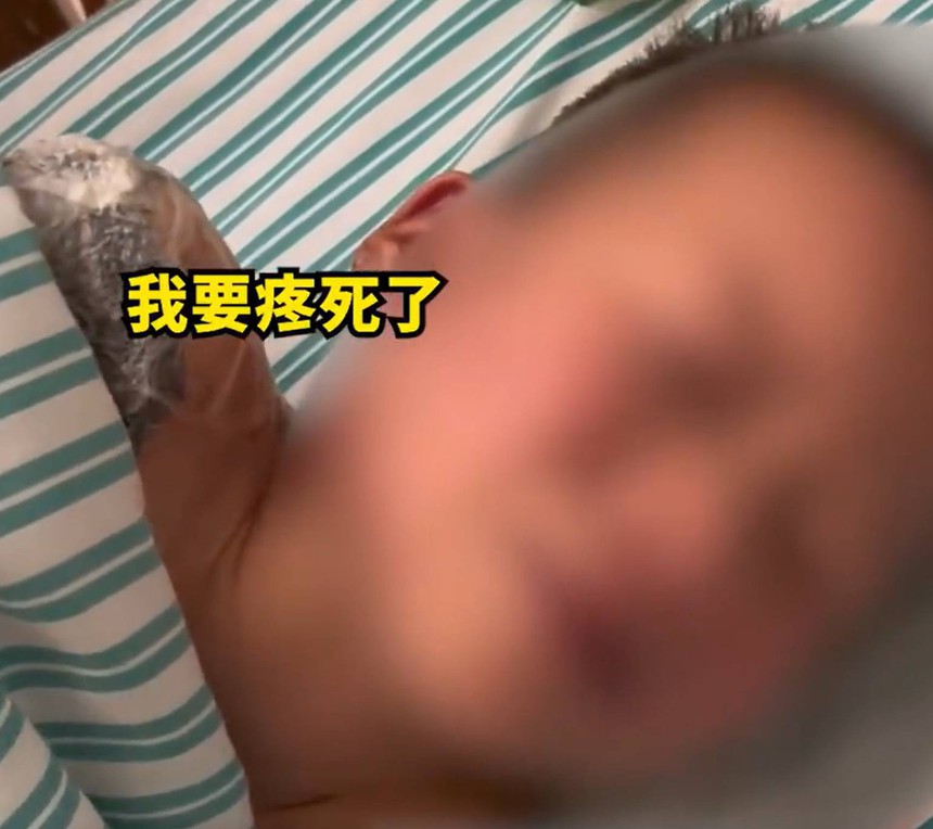 "Mẹ ơi, con đau chết mất" - cậu nhóc 7 tuổi đang chơi trước nhà nhưng bị cắt cụt tay, bóng ma tâm lý đi theo suốt đời vì một sai lầm của hàng xóm - Ảnh 3. "Mẹ ơi, con đau chết mất" - cậu nhóc 7 tuổi đang chơi trước nhà nhưng bị cắt cụt tay, bóng ma tâm lý đi theo suốt đời vì một sai lầm của hàng xóm - Ảnh 3.