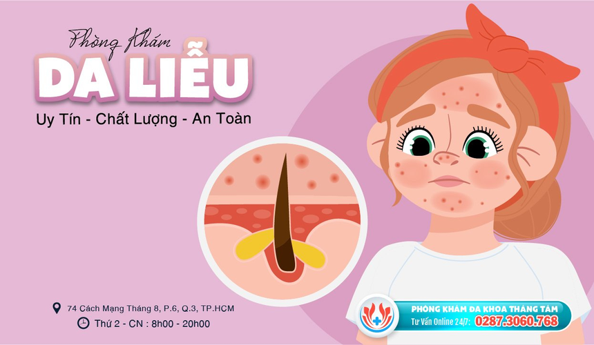 Phòng khám đa khoa da liễu ngoài giờ uy tín - Ảnh 1.
