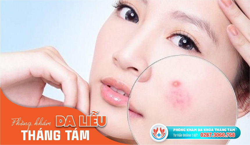 Phòng khám đa khoa da liễu ngoài giờ uy tín - Ảnh 2.