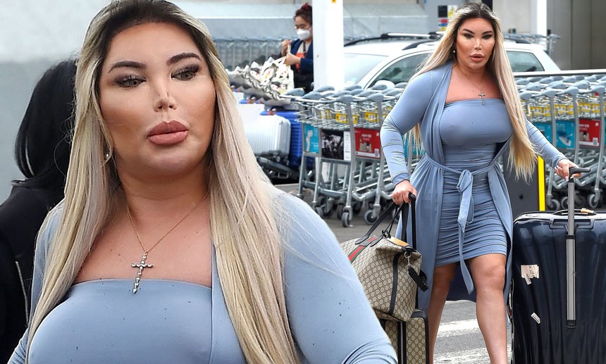 Vung 21 tỷ đồng phẫu thuật để có được vẻ ngoài hoàn hảo, ngoại hình méo mó dị thường của "Barbie sống" giờ đây khiến dân mạng sốc nặng - Ảnh 6.