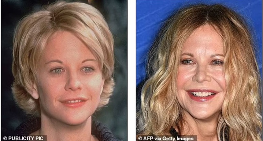 Theo đuổi vẻ trẻ trung mà đánh mất đi khuôn mặt của chính mình - Những celeb phẫu thuật thẩm mỹ khiến fan choáng váng - Ảnh 8.