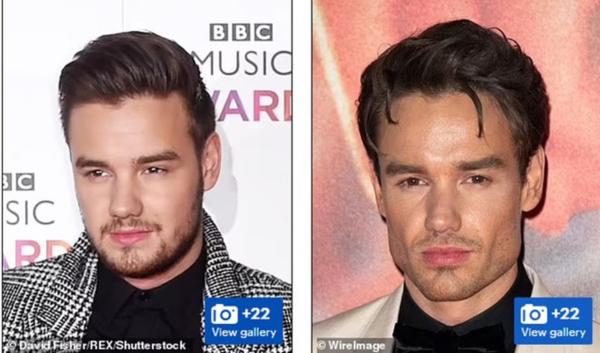 Theo đuổi vẻ trẻ trung mà đánh mất đi khuôn mặt của chính mình - Những celeb phẫu thuật thẩm mỹ khiến fan choáng váng - Ảnh 16.