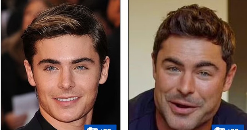 Theo đuổi vẻ trẻ trung mà đánh mất đi khuôn mặt của chính mình - Những celeb phẫu thuật thẩm mỹ khiến fan choáng váng - Ảnh 12.