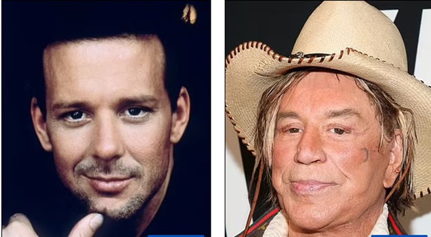 Theo đuổi vẻ trẻ trung mà đánh mất đi khuôn mặt của chính mình - Những celeb phẫu thuật thẩm mỹ khiến fan choáng váng - Ảnh 13.