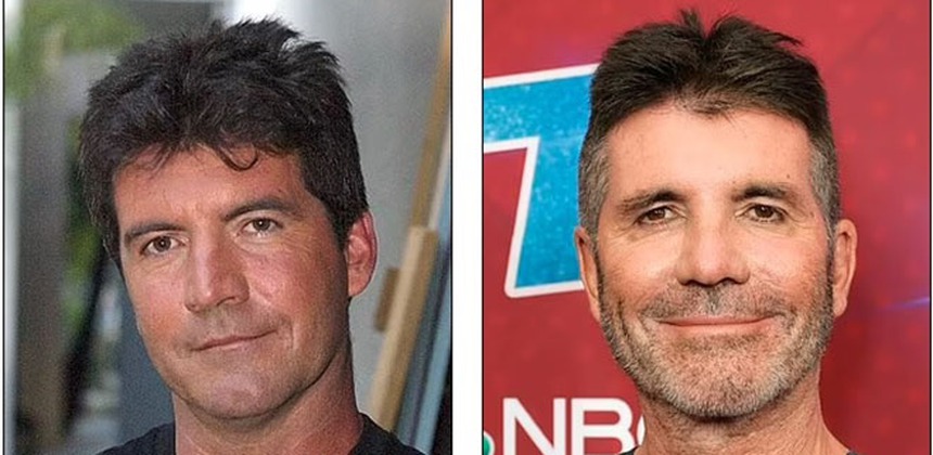 Theo đuổi vẻ trẻ trung mà đánh mất đi khuôn mặt của chính mình - Những celeb phẫu thuật thẩm mỹ khiến fan choáng váng - Ảnh 17.