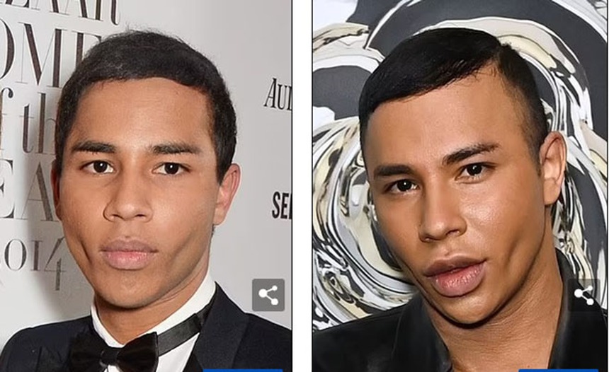 Theo đuổi vẻ trẻ trung mà đánh mất đi khuôn mặt của chính mình - Những celeb phẫu thuật thẩm mỹ khiến fan choáng váng - Ảnh 18.