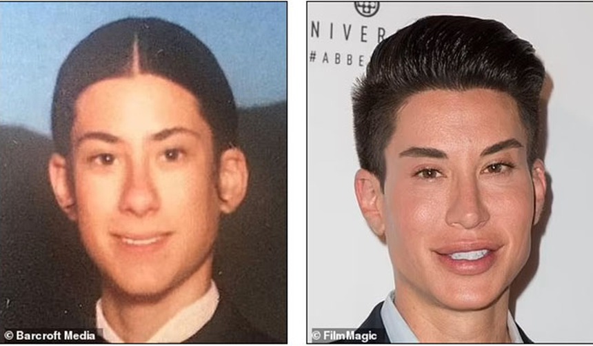 Theo đuổi vẻ trẻ trung mà đánh mất đi khuôn mặt của chính mình - Những celeb phẫu thuật thẩm mỹ khiến fan choáng váng - Ảnh 19.