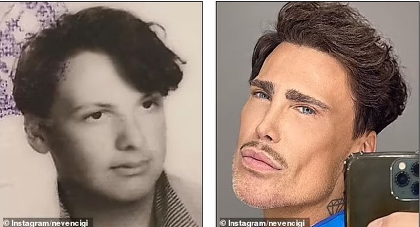 Theo đuổi vẻ trẻ trung mà đánh mất đi khuôn mặt của chính mình - Những celeb phẫu thuật thẩm mỹ khiến fan choáng váng - Ảnh 20.