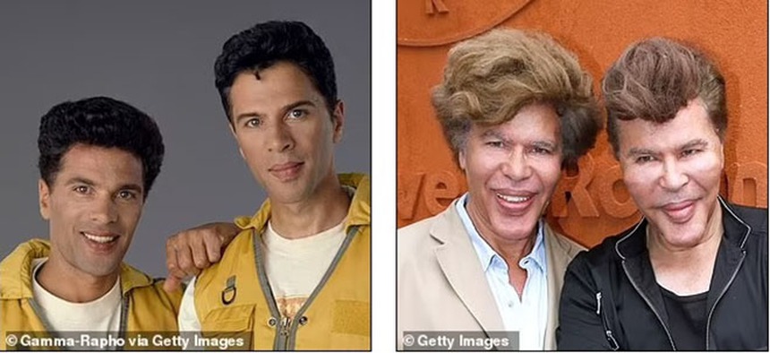 Theo đuổi vẻ trẻ trung mà đánh mất đi khuôn mặt của chính mình - Những celeb phẫu thuật thẩm mỹ khiến fan choáng váng - Ảnh 21.