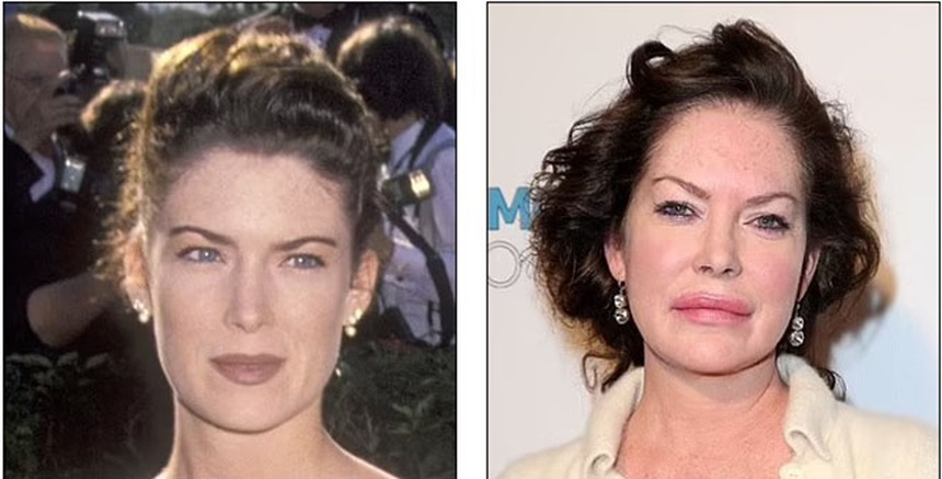 Theo đuổi vẻ trẻ trung mà đánh mất đi khuôn mặt của chính mình - Những celeb phẫu thuật thẩm mỹ khiến fan choáng váng - Ảnh 3.