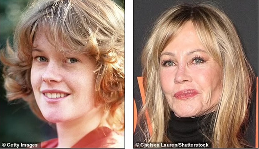 Theo đuổi vẻ trẻ trung mà đánh mất đi khuôn mặt của chính mình - Những celeb phẫu thuật thẩm mỹ khiến fan choáng váng - Ảnh 7.