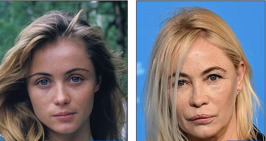 Theo đuổi vẻ trẻ trung mà đánh mất đi khuôn mặt của chính mình - Những celeb phẫu thuật thẩm mỹ khiến fan choáng váng - Ảnh 9.