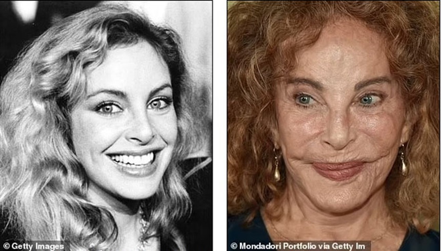 Theo đuổi vẻ trẻ trung mà đánh mất đi khuôn mặt của chính mình - Những celeb phẫu thuật thẩm mỹ khiến fan choáng váng - Ảnh 10.