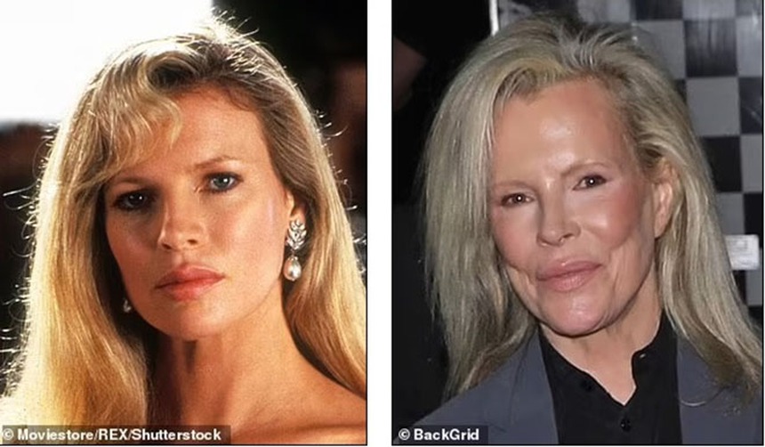 Theo đuổi vẻ trẻ trung mà đánh mất đi khuôn mặt của chính mình - Những celeb phẫu thuật thẩm mỹ khiến fan choáng váng - Ảnh 2.