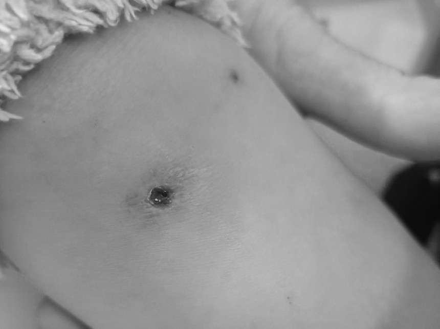 Giao mùa, bệnh viện liên tiếp tiếp nhận các ca mắc thuỷ đậu: Bệnh quen thuộc nhưng biến chứng khôn lường, gây viêm não, động kinh nếu không chữa kịp thời - Ảnh 2. Giao mùa, bệnh viện liên tiếp tiếp nhận các ca mắc thuỷ đậu: Bệnh quen thuộc nhưng biến chứng khôn lường, gây viêm não, động kinh nếu không chữa kịp thời - Ảnh 2.