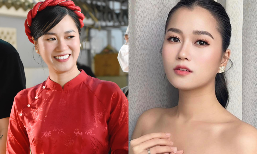 Lâm Vỹ Dạ lộ nhan sắc khác lạ làm dấy lên nghi vấn can thiệp 'dao kéo'? - Ảnh 5.