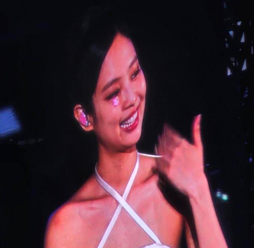 Xuất hiện với chấn thương mặt, Jennie Blackpink gây xót xa vì làm điều này - Ảnh 2.