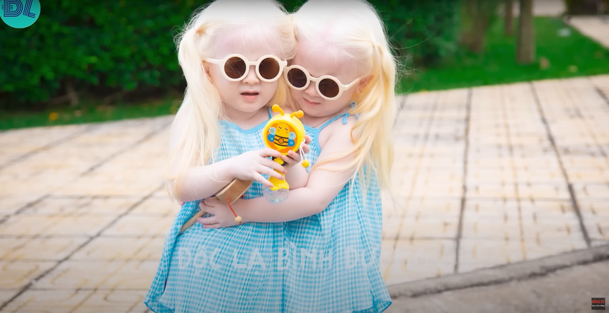 Đẻ ra cặp song sinh kỳ lạ, vợ chồng Sóc Trăng tuyệt vọng, 4 năm sau bỗng nổi tiếng khắp vùng - Ảnh 5.