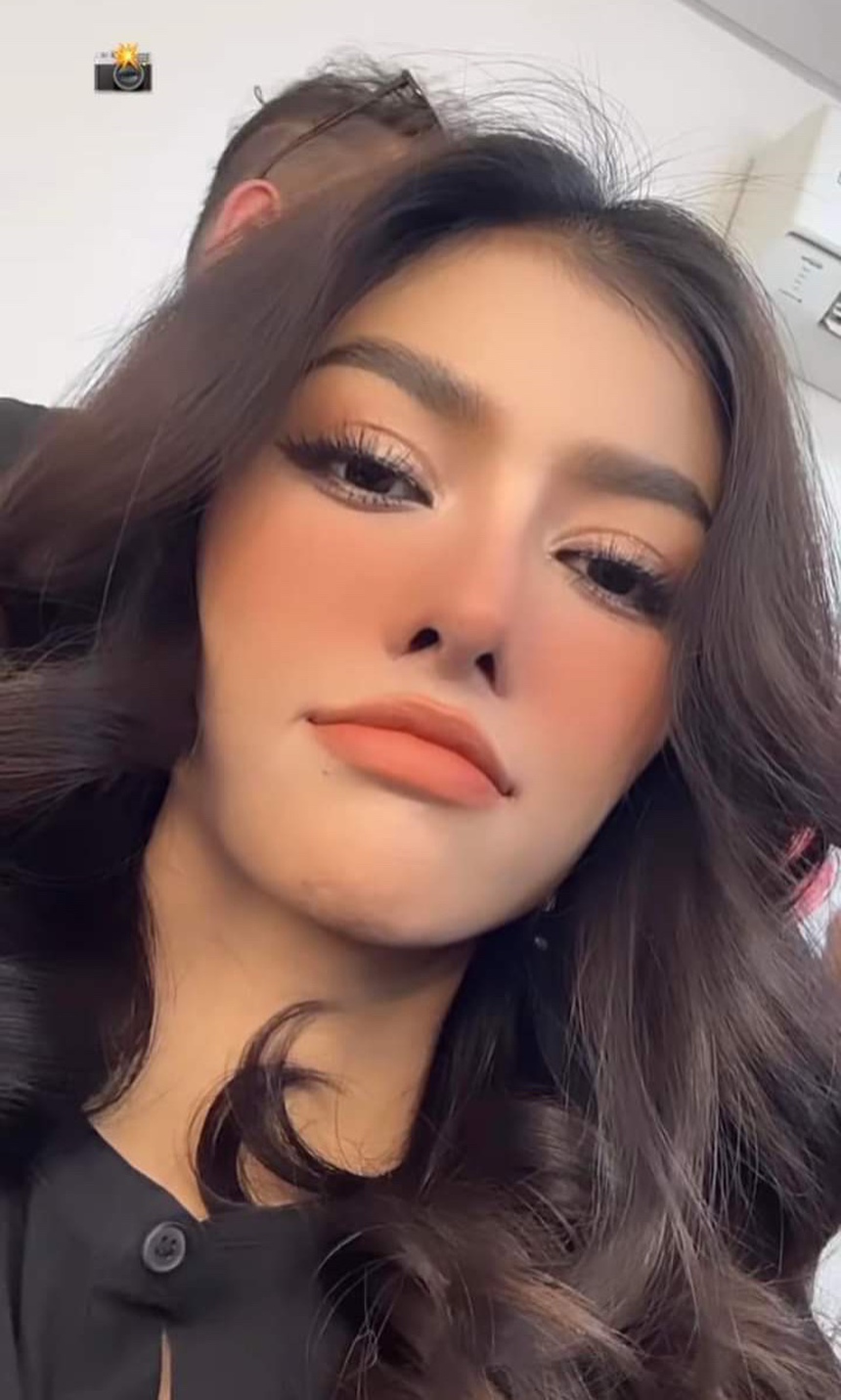  Á hậu Kiều Loan để lộ mũi xộc xệch hậu nghi vấn phẫu thuật thẩn mỹ, gương mặt khi lột hết make-up khó nhận ra   - Ảnh 1.