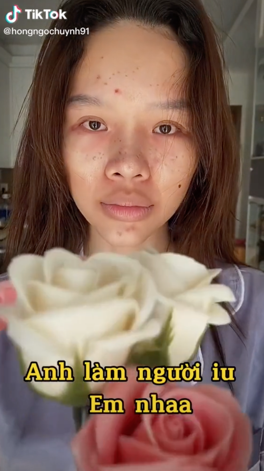 TikToker Đồng Tháp nổi lên với danh xưng “vịt hoá thiên nga” chi hẳn 300 triệu đi sửa mũi, netizen thảng thốt: “Mũi gì tận 300 củ?” - Ảnh 5. TikToker Đồng Tháp nổi lên với danh xưng “vịt hoá thiên nga” chi hẳn 300 triệu đi sửa mũi, netizen thảng thốt: “Mũi gì tận 300 củ?” - Ảnh 5.