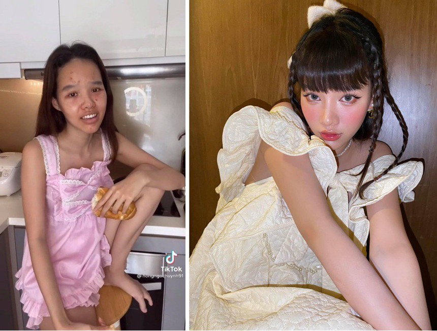 TikToker Đồng Tháp nổi lên với danh xưng “vịt hoá thiên nga” chi hẳn 300 triệu đi sửa mũi, netizen thảng thốt: “Mũi gì tận 300 củ?” - Ảnh 1. TikToker Đồng Tháp nổi lên với danh xưng “vịt hoá thiên nga” chi hẳn 300 triệu đi sửa mũi, netizen thảng thốt: “Mũi gì tận 300 củ?” - Ảnh 1.