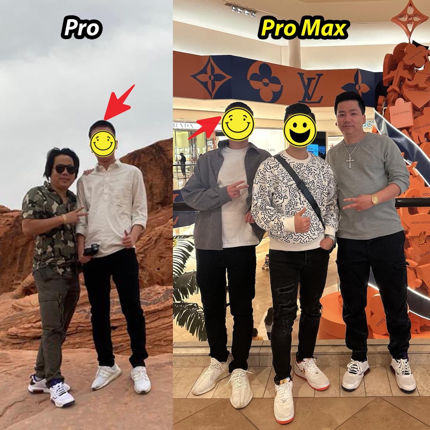 Khoa Pug đăng ảnh trước và sau khi kéo chân 5 tỷ, bị chê mất cân đối nhưng nhìn lại đúng là quá "lột xác" - Ảnh 1. Khoa Pug đăng ảnh trước và sau khi kéo chân 5 tỷ, bị chê mất cân đối nhưng nhìn lại đúng là quá "lột xác" - Ảnh 1.