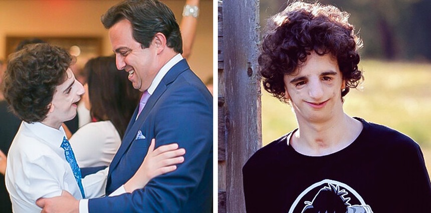 Từ nhỏ đã bị xa lánh và gọi là "quái vật" vì ngoại hình méo mó, cuộc sống của cậu bé nguyên mẫu trong bộ phim Wonder bây giờ ra sao? - Ảnh 5.