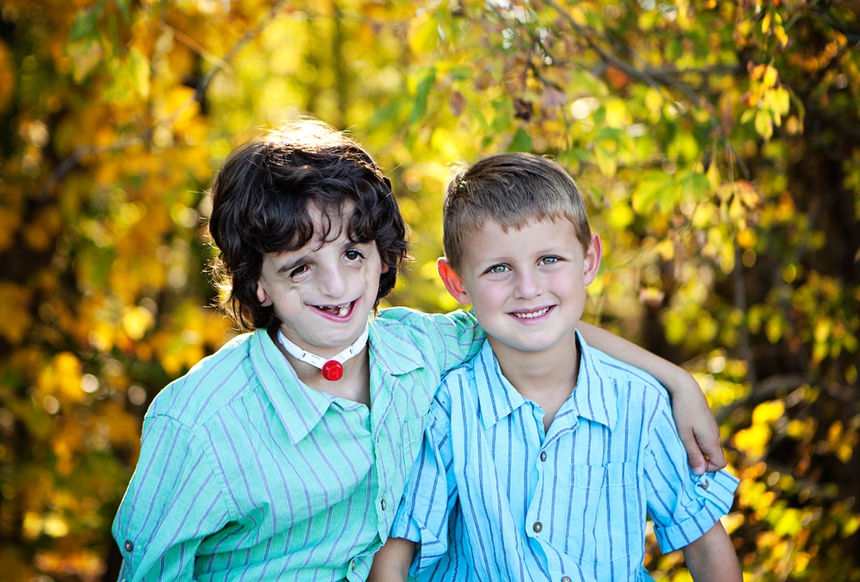 Từ nhỏ đã bị xa lánh và gọi là "quái vật" vì ngoại hình méo mó, cuộc sống của cậu bé nguyên mẫu trong bộ phim Wonder bây giờ ra sao? - Ảnh 3.