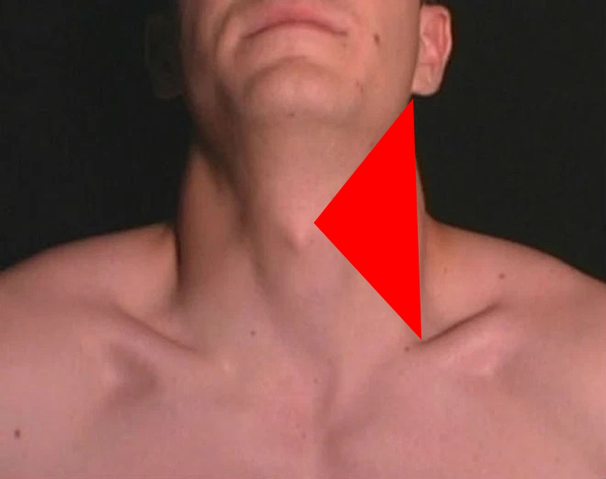 Bác sĩ nhắc nhở: 1 vị trí trên cơ thể là vùng "tam giác chết", không được để người khác chạm vào hay xoa bóp kẻo "chuốc họa vào thân" - Ảnh 1.